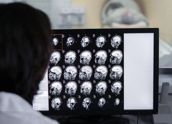 Чтение плохих новостей ломает систему стресса в мозге: как это работает