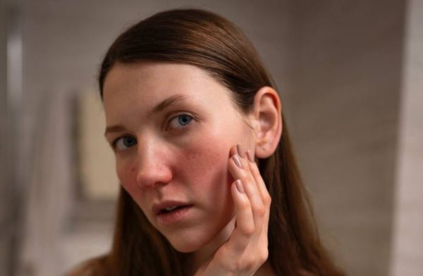 ИИ-косметолог для людей с проблемной кожей появился в России